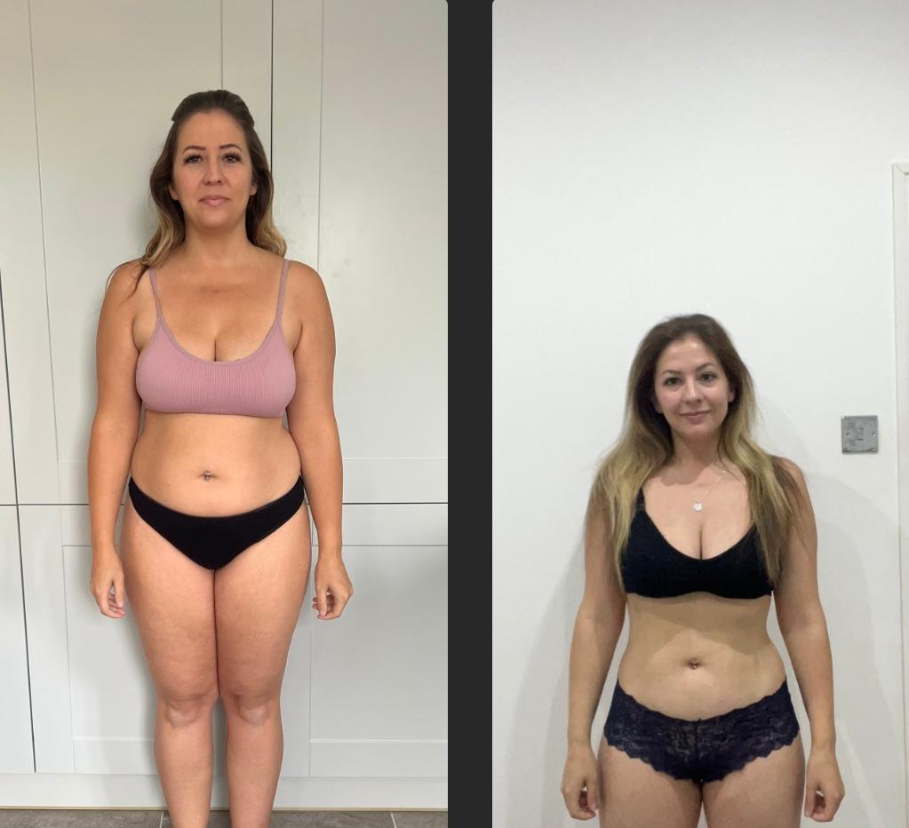 Client transformation - Front view before and after