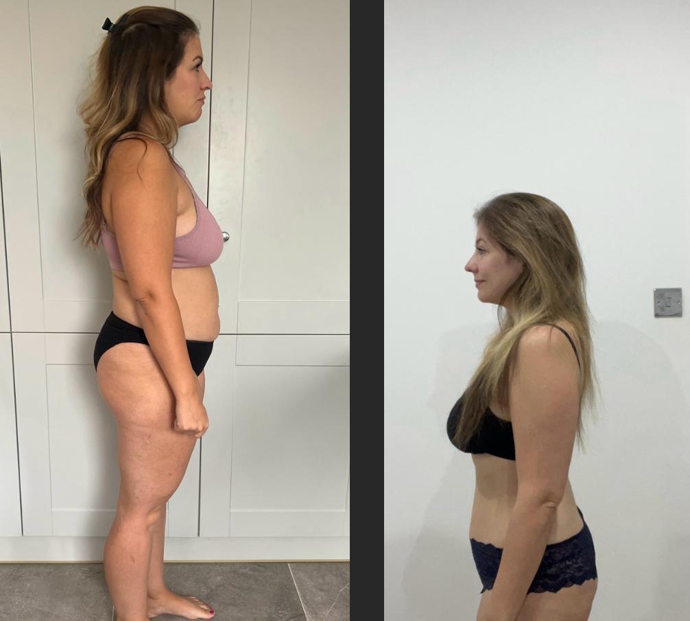 Client transformation - Side view before and after
